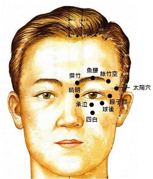 過度用眼引發頭痛1
