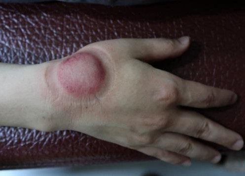 大姆指手機症候群9